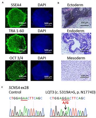 Propranolol Attenuates Late Sodium Current in a Long QT Syndrome Type 3-Human Induced Pluripotent Stem Cell Model